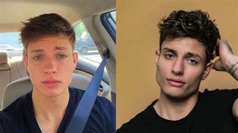 matt rife before and after plastic surgery|Matt Rife Says Delayed Puberty Is Reason for Face Change, Not。